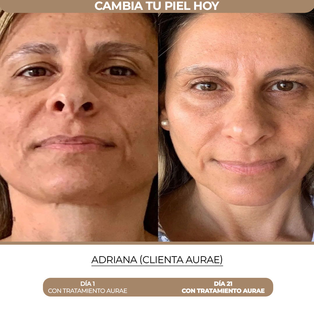 Pack Rejuvenecimiento para Arrugas, Flacidez y Definición de Contorno Aurae