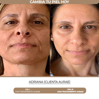 Pack Rejuvenecimiento para Arrugas, Flacidez y Definición de Contorno Aurae